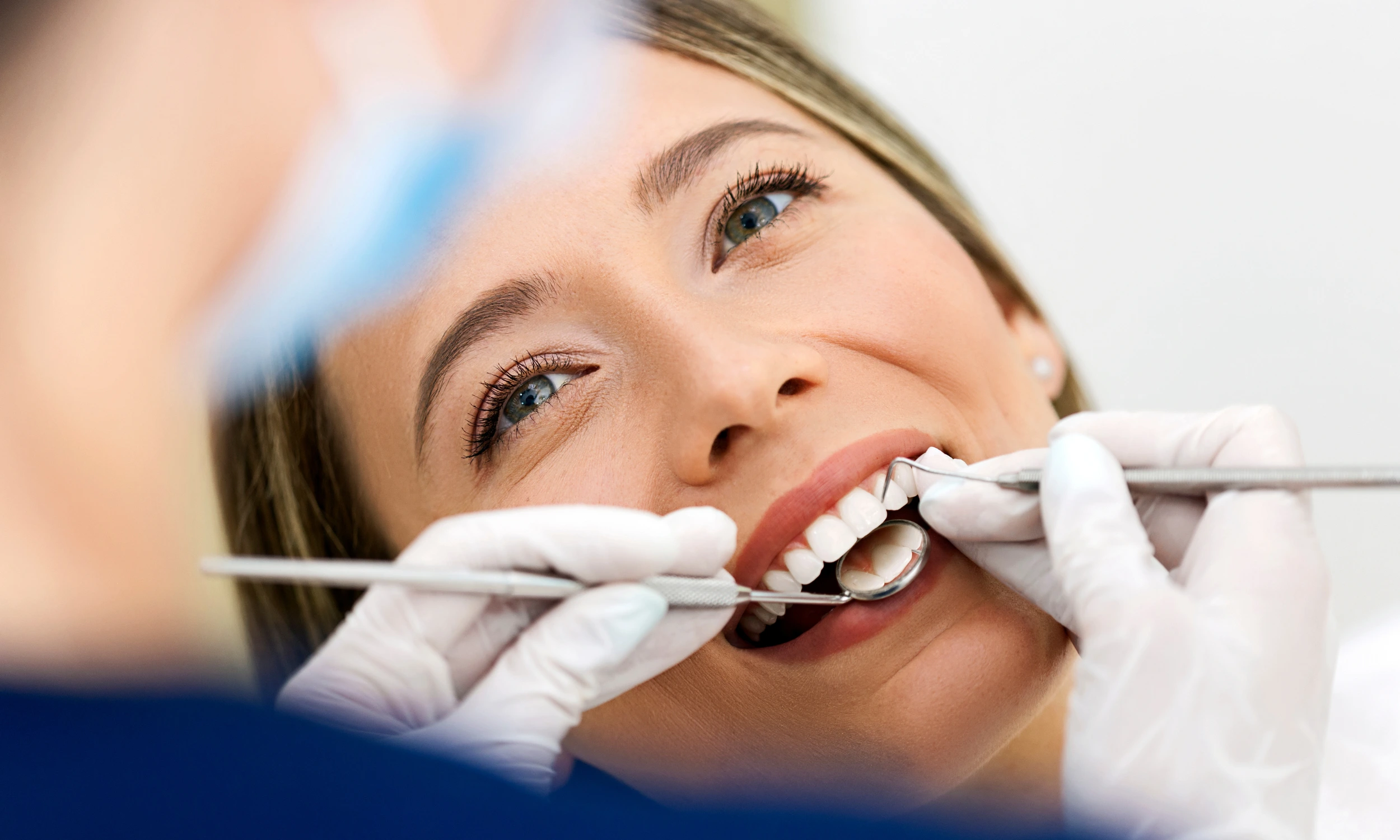 Composite Bonding in Lincoln