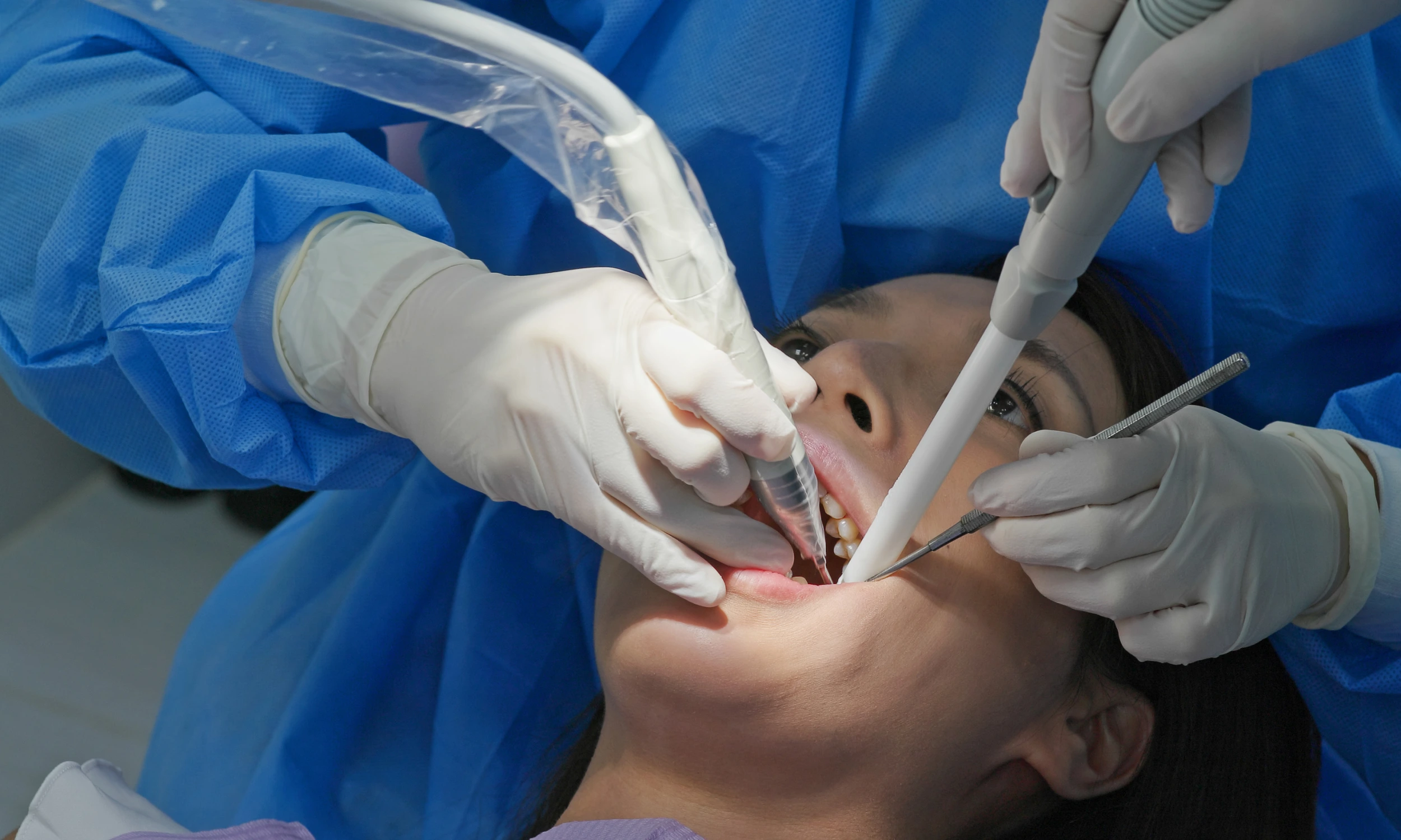 Dental Implants in Nottingham: Everything You Need to Know