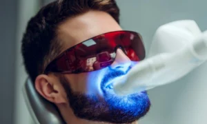Teeth Whitening in Sheffield: Professional Results vs DIY Kits